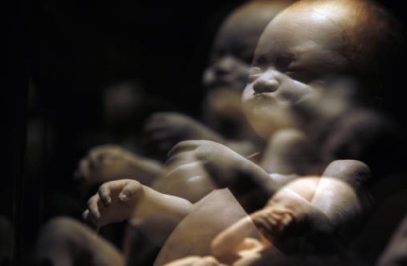 A plastinated fetus is seen during the exhibition "Body Worlds" by Gunther von Hagen in Rome (photo credit: REUTERS)