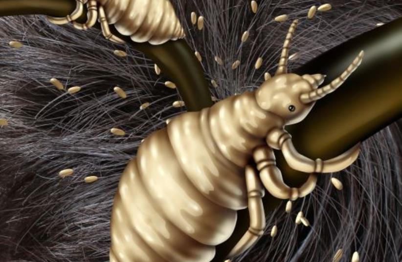 Head lice (photo credit: ING IMAGE/ASAP)