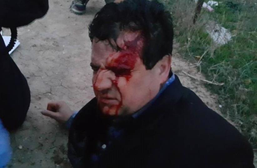 Ayman Odeh  (photo credit: Courtesy)