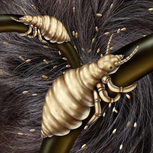 Head lice (credit: ING IMAGE/ASAP)