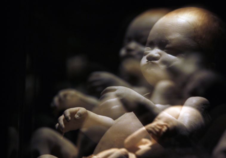 A plastinated fetus is seen during the exhibition "Body Worlds" by Gunther von Hagen in Rome
