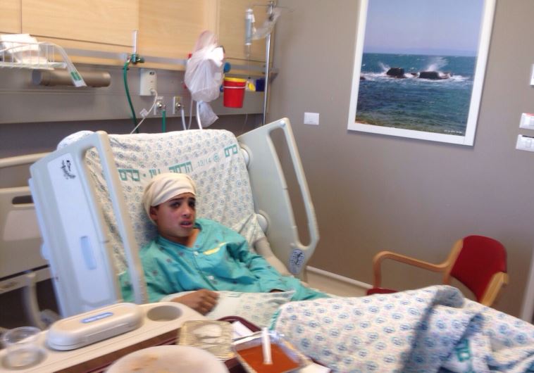 13-year-old east Jerusalem boy who carried out stabbing attack in Pisgat Ze'ev hospitalized at Hadassah University Medical Center in Jerusalem's Ein Kerem‏
