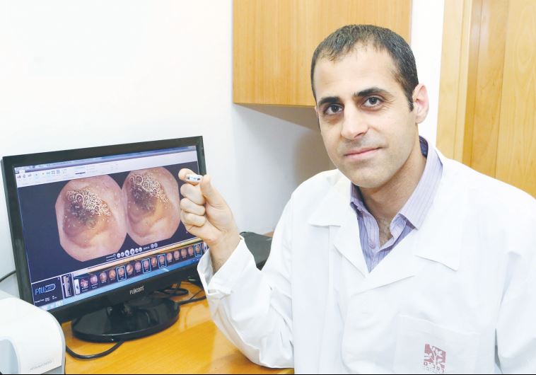 DR. ITAI MAZA shows off Given Imaging’s colorectal cancer Pillcam