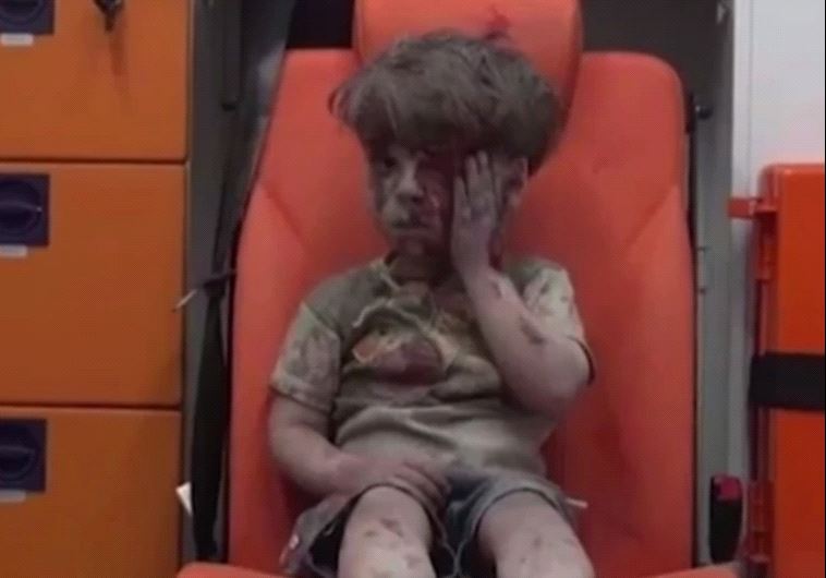 Young Omran Daqneesh, bloodied and dazed, was pulled from the rubble in Aleppo.