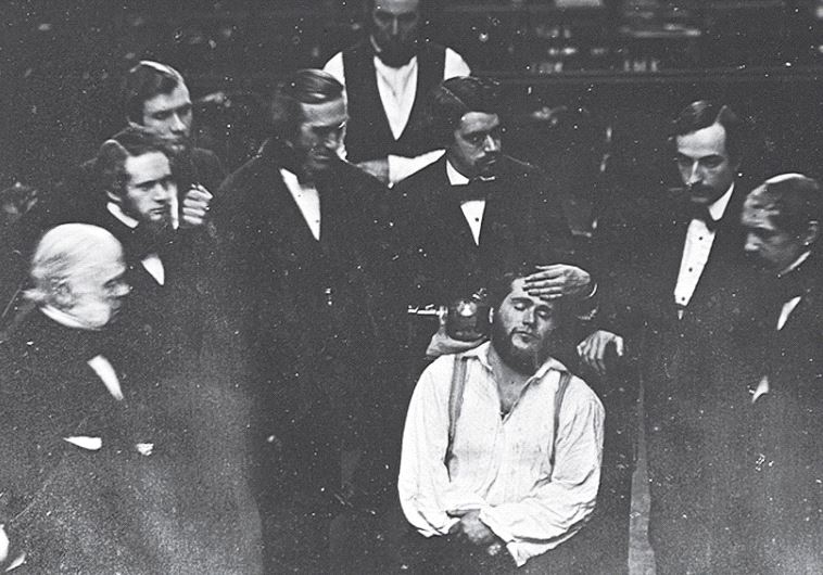 A daguerreotype of Albert Southworth and Josiah Hawes of early ether anesthesia in Massachusetts General Hospital, Boston