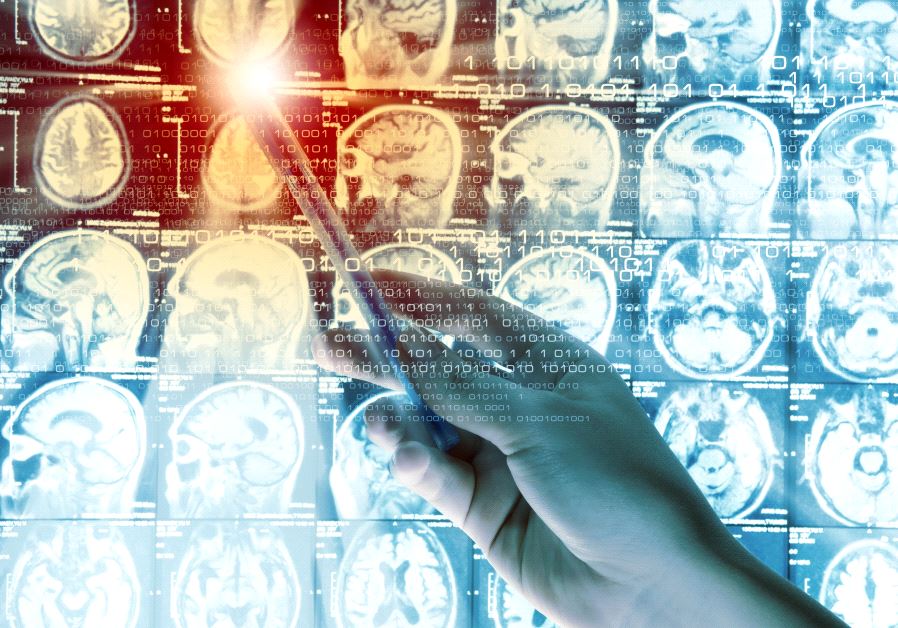 Brain scan (illustrative)
