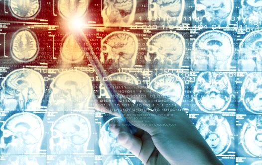 Brain scan (illustrative)
