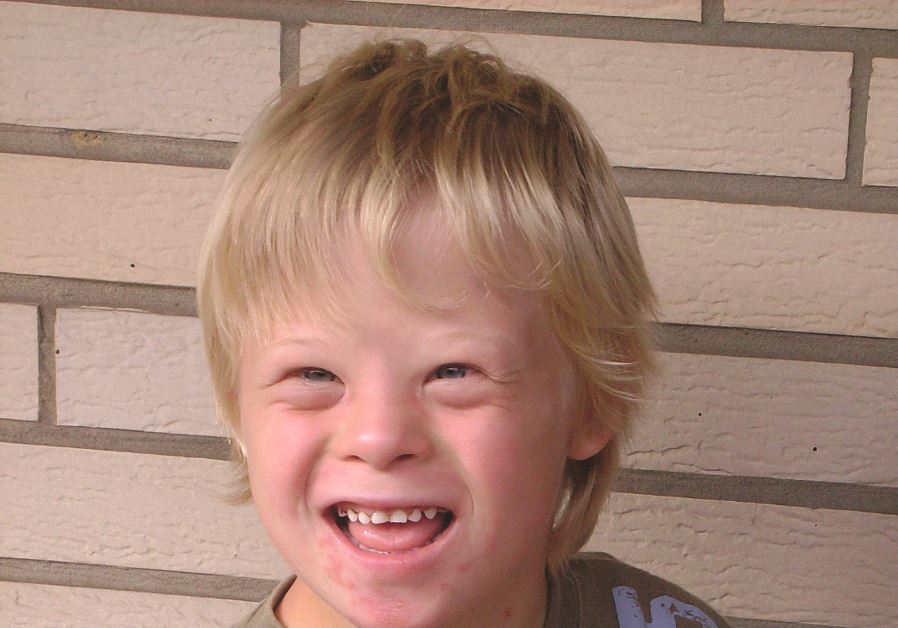 Un enfant atteint du syndrome de Down